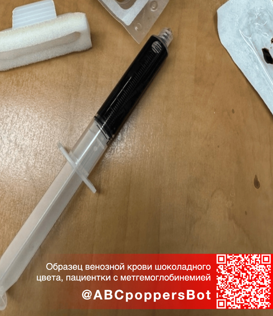 Если принять попперс внутрь в Чите это вызывает метгемоглобинемию. Смертельное состояние Если принять попперс внутрь в Чите это вызывает метгемоглобинемию. Смертельное состояние